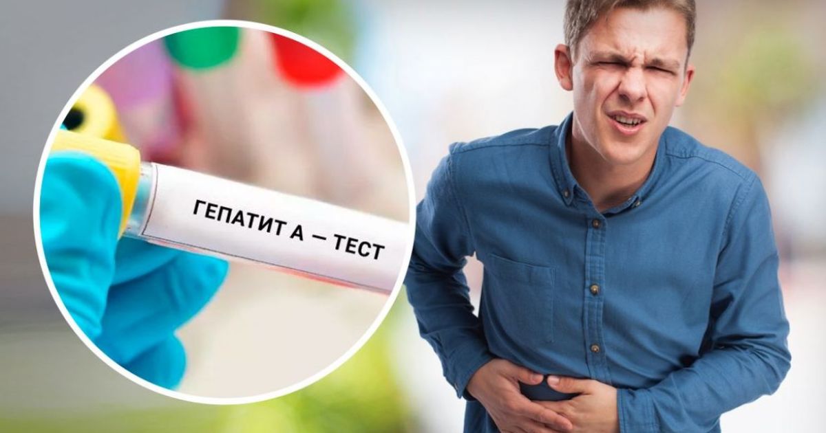 гепатит А